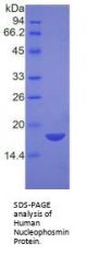 Human Nucleophosmin (NPM1) Protein