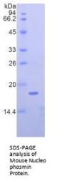 Mouse Nucleophosmin (NPM1) Protein