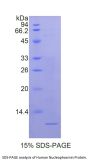 Human Nucleophosmin (NPM1) Protein