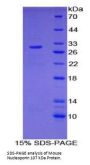 Mouse Nucleoporin 107 kDa (NUP107) Protein