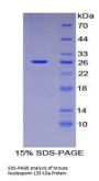 Mouse Nucleoporin 133 kDa (NUP133) Protein