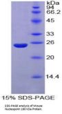 Mouse Nucleoporin 160 kDa (NUP160) Protein