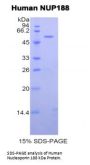 Human Nucleoporin 188 kDa (NUP188) Protein