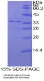 Human Nucleoporin 205 kDa (NUP205) Protein