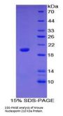 Mouse Nucleoporin 210 kDa / gp210 (NUP210) Protein