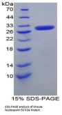 Mouse Nucleoporin 50 kDa (NUP50) Protein