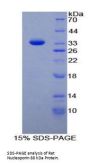 Rat Nucleoporin 88 kDa (NUP88) Protein