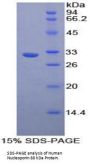 Human Nucleoporin 88 kDa (NUP88) Protein