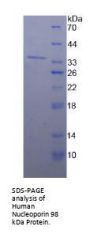 Human Nucleoporin 98 kDa (NUP98) Protein