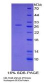 Mouse Nucleoporin 98 kDa (NUP98) Protein
