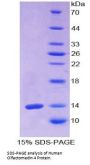 Human Olfactomedin 4 (OLFM4) Protein