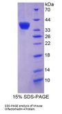 Mouse Olfactomedin 4 (OLFM4) Protein