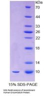 Human Oncomodulin (OCM) Protein