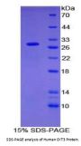 Human Oncoprotein Induced Transcript 3 (OIT3) Protein