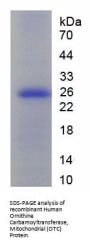 Human Ornithine Carbamoyl Transferase (OTC) Protein