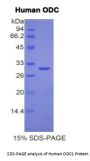 Human Ornithine Decarboxylase (ODC1) Protein