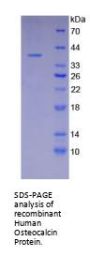 Human Osteocalcin (BGLAP) Protein