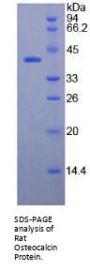 Rat Osteocalcin (BGLAP) Protein