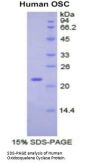 Human Oxidosqualene Cyclase (OSC) Protein