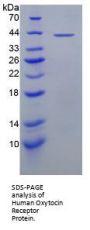 Human Oxytocin Receptor (OXTR) Protein
