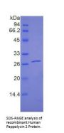 Human Pappalysin 2 (PAPPA2) Protein