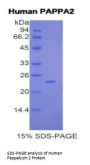 Human Pappalysin 2 (PAPPA2) Protein
