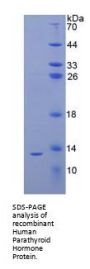 Human Parathyroid Hormone (PTH) Protein