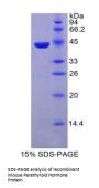 Mouse Parathyroid Hormone (PTH) Protein