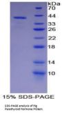 Pig Parathyroid Hormone (PTH) Protein