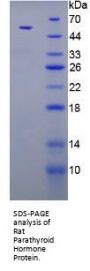 Rat Parathyroid Hormone (PTH) Protein