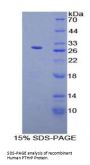 Human Parathyroid Hormone-Related Protein / PTHrP (PTHLH) Protein