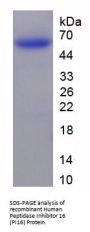 Human Peptidase Inhibitor 16 (PI16) Protein