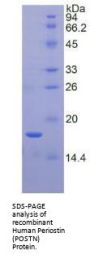 Human Periostin (POSTN) Protein