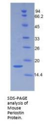 Mouse Periostin (POSTN) Protein