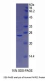 Human Peripheral Myelin Protein 22 (PMP22) Protein