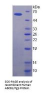 Human ATP-Dependent Translocase ABCB1 (ABCB1) Protein