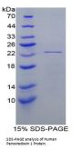 Human Peroxiredoxin 1 (PRDX1) Protein