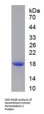 Human Peroxiredoxin 2 (PRDX2) Protein