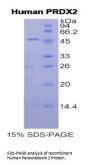 Human Peroxiredoxin 2 (PRDX2) Protein