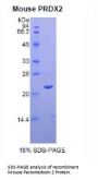 Mouse Peroxiredoxin 2 (PRDX2) Protein