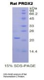 Rat Peroxiredoxin 2 (PRDX2) Protein