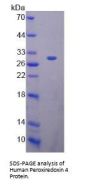 Human Peroxiredoxin 4 (PRDX4) Protein