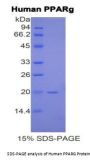 Human Peroxisome Proliferator Activated Receptor Gamma (PPARg) Protein