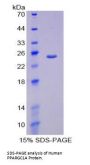 Human Peroxisome Proliferator Activated Receptor Gamma Coactivator 1 Alpha (PPARgC1a) Protein