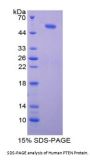 Human Phosphatase And Tensin Homolog (PTEN) Protein