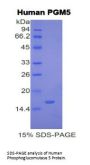 Human Phosphoglucomutase 5 (PGM5) Protein