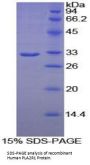Human Phospholipase A2 Receptor 1 (PLA2R1) Protein