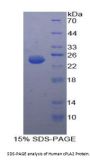Human Cytosolic Phospholipase A2 (PLA2G4A) Protein