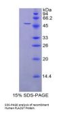Human Platelet-Activating Factor Acetylhydrolase (PLA2G7) Protein