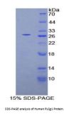 Human Phospholipase C Gamma 1 (PLCg1) Protein
